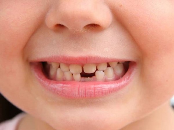 Giải mã giấc mơ thấy bị rụng răng báo điềm gì, đánh con gì?